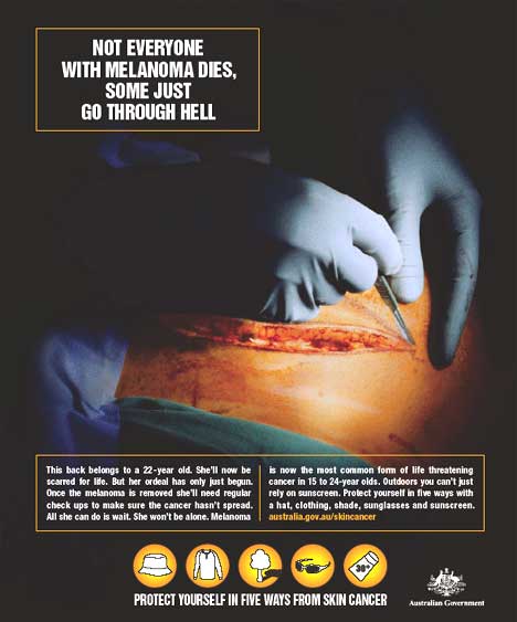 Effects of melanoma - poster in Australian skin cancer awareness campaign